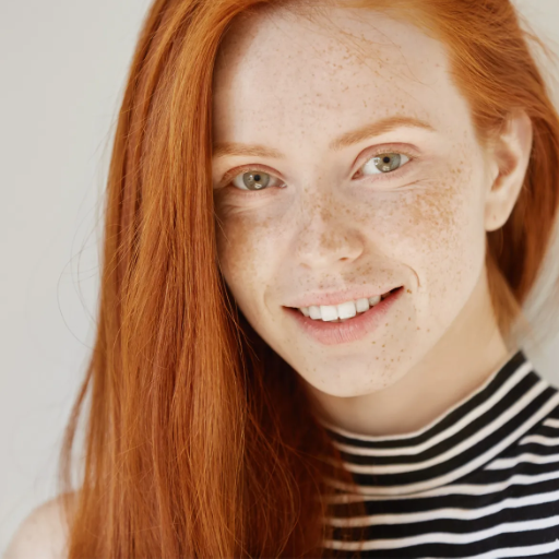 What Are Freckles?