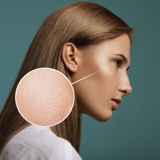 What Causes Large Pores and How Can You Minimize the Appearance