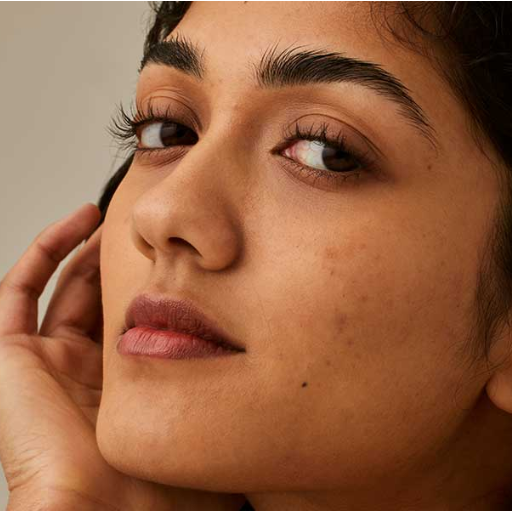 What is Melasma and How Does It Relate to Hyperpigmentation