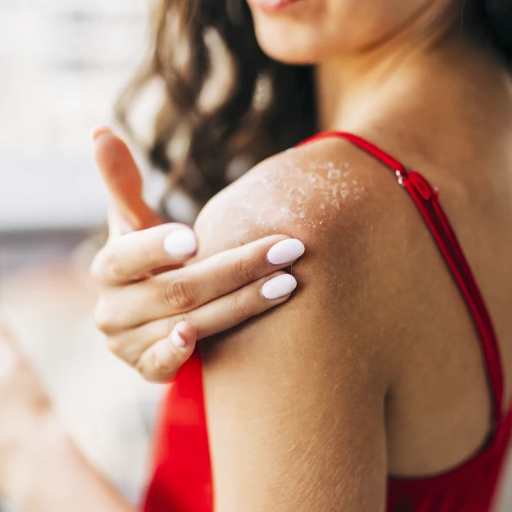 Top Home Remedies for Sunburn Relief