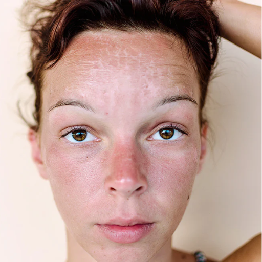 When should I consult a dermatologist about sun-damaged skin?